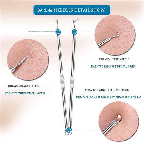 4pcs Stainless Steel Facial Acne Blackhead Remover Needles Kit Extractor Tool Set - Image 7