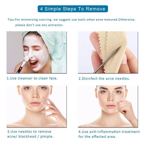 4pcs Stainless Steel Facial Acne Blackhead Remover Needles Kit Extractor Tool Set - Image 6